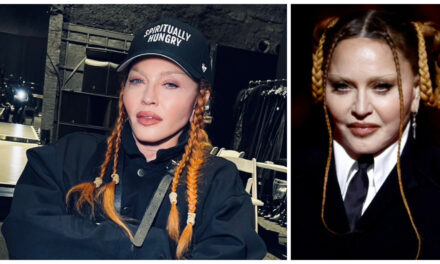 Madonna presume su rostro desinflamado tras críticas; ‘miren lo linda que estoy’<