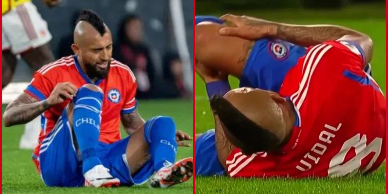 Arturo Vidal fue operado tras lesión con Chile